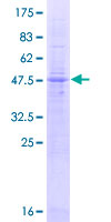 LAPTM4A Protein - 12.5% SDS-PAGE of human LAPTM4A stained with Coomassie Blue