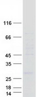 LAPTM4A Protein - Purified recombinant protein LAPTM4A was analyzed by SDS-PAGE gel and Coomassie Blue Staining