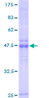 LAPTM4B Protein - 12.5% SDS-PAGE of human LAPTM4B stained with Coomassie Blue