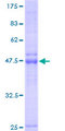 LAPTM4B Protein - 12.5% SDS-PAGE of human LAPTM4B stained with Coomassie Blue