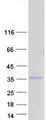 LAPTM4B Protein - Purified recombinant protein LAPTM4B was analyzed by SDS-PAGE gel and Coomassie Blue Staining