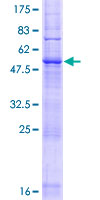 LAPTM5 Protein - 12.5% SDS-PAGE of human LAPTM5 stained with Coomassie Blue