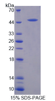 LARGE Protein - Recombinant Like Glycosyltransferase By SDS-PAGE
