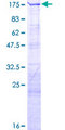 LARP1 / La-Related Protein 1 Protein - 12.5% SDS-PAGE of human LARP1 stained with Coomassie Blue