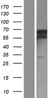 LARP1B Protein - Western validation with an anti-DDK antibody * L: Control HEK293 lysate R: Over-expression lysate