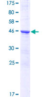 LARP1B Protein - 12.5% SDS-PAGE of human LARP2 stained with Coomassie Blue