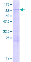 LARP6 / ACHN Protein - 12.5% SDS-PAGE of human LARP6 stained with Coomassie Blue