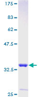 LARP7 Protein - 12.5% SDS-PAGE of human HDCMA18P stained with Coomassie Blue