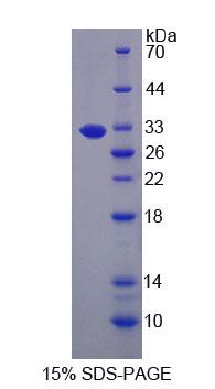 LARS / Leucyl-TRNA Synthetase Protein - Recombinant Leucyl tRNA Synthetase (LARS) by SDS-PAGE
