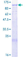 LARS2 / LEURS1 Protein - 12.5% SDS-PAGE of human LARS2 stained with Coomassie Blue