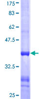 LARS2 / LEURS1 Protein - 12.5% SDS-PAGE Stained with Coomassie Blue.