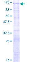 LAS1L Protein - 12.5% SDS-PAGE of human LAS1L stained with Coomassie Blue