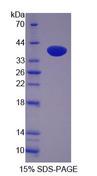 LASP1 Protein - Recombinant  LIM And SH3 Protein 1 By SDS-PAGE