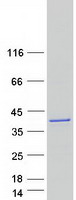 LASP1 Protein - Purified recombinant protein LASP1 was analyzed by SDS-PAGE gel and Coomassie Blue Staining