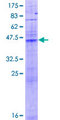 LASS1 Protein - 12.5% SDS-PAGE of human LASS1 stained with Coomassie Blue