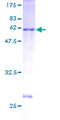 LAT Protein - 12.5% SDS-PAGE of human LAT stained with Coomassie Blue