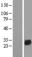 LAT2 / NTAL Protein - Western validation with an anti-DDK antibody * L: Control HEK293 lysate R: Over-expression lysate