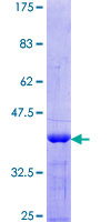 LAT2 / NTAL Protein - 12.5% SDS-PAGE Stained with Coomassie Blue.