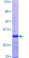 LAT2 / NTAL Protein - 12.5% SDS-PAGE Stained with Coomassie Blue.