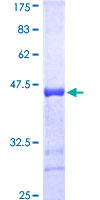 LATS1 Protein - 12.5% SDS-PAGE Stained with Coomassie Blue.