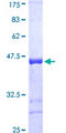 LATS1 Protein - 12.5% SDS-PAGE Stained with Coomassie Blue.