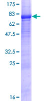LAX1 / LAX Protein - 12.5% SDS-PAGE of human LAX1 stained with Coomassie Blue