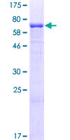 Layilin / LAYN Protein - 12.5% SDS-PAGE of human LAYN stained with Coomassie Blue