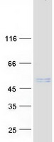 LBHD1 / C11orf48 Protein - Purified recombinant protein LBHD1 was analyzed by SDS-PAGE gel and Coomassie Blue Staining