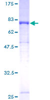 LBP Protein - 12.5% SDS-PAGE of human LBP stained with Coomassie Blue