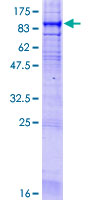LBR / Lamin B Receptor Protein - 12.5% SDS-PAGE of human LBR stained with Coomassie Blue