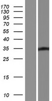 LBX1 Protein - Western validation with an anti-DDK antibody * L: Control HEK293 lysate R: Over-expression lysate