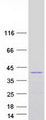 LBX1 Protein - Purified recombinant protein LBX1 was analyzed by SDS-PAGE gel and Coomassie Blue Staining