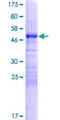 LBX2 Protein - 12.5% SDS-PAGE of human LBX2 stained with Coomassie Blue