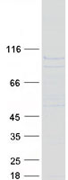 LCA3 / SPATA7 Protein - Purified recombinant protein SPATA7 was analyzed by SDS-PAGE gel and Coomassie Blue Staining