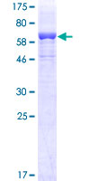 LCAT Protein - 12.5% SDS-PAGE of human LCAT stained with Coomassie Blue
