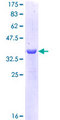 LCAT Protein - 12.5% SDS-PAGE Stained with Coomassie Blue.