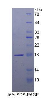 LCAT Protein - Recombinant Lecithin Cholesterol Acyltransferase By SDS-PAGE