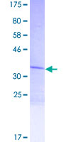 LCE1C Protein - 12.5% SDS-PAGE of human LCE1C stained with Coomassie Blue