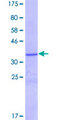 LCE1F Protein - 12.5% SDS-PAGE of human LCE1F stained with Coomassie Blue