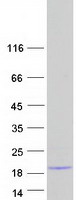 LCE6A Protein - Purified recombinant protein LCE6A was analyzed by SDS-PAGE gel and Coomassie Blue Staining