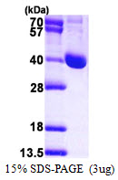 LCMT1 Protein