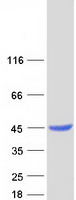 LCMT1 Protein - Purified recombinant protein LCMT1 was analyzed by SDS-PAGE gel and Coomassie Blue Staining
