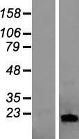 LCN1 / Lipocalin-1 Protein - Western validation with an anti-DDK antibody * L: Control HEK293 lysate R: Over-expression lysate