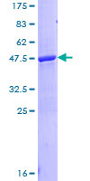 LCN1 / Lipocalin-1 Protein - 12.5% SDS-PAGE of human LCN1 stained with Coomassie Blue