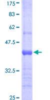 LCN1 / Lipocalin-1 Protein - 12.5% SDS-PAGE Stained with Coomassie Blue.