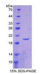 LCN1 / Lipocalin-1 Protein - Recombinant Lipocalin 1 By SDS-PAGE