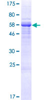 LCN12 Protein - 12.5% SDS-PAGE of human LCN12 stained with Coomassie Blue
