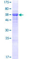 LCN12 Protein - 12.5% SDS-PAGE of human LCN12 stained with Coomassie Blue