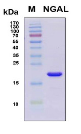 LCN2 / Lipocalin 2 / NGAL Protein - SDS-PAGE under reducing conditions and visualized by Coomassie blue staining