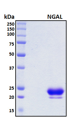 LCN2 / Lipocalin 2 / NGAL Protein - SDS-PAGE under reducing conditions and visualized by Coomassie blue staining